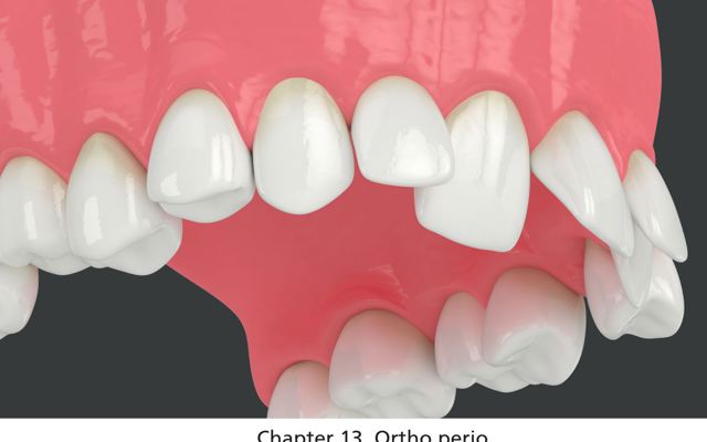 Figure 13 Ortho Perio